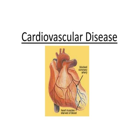Types of cardiovascular diseases | PPTX