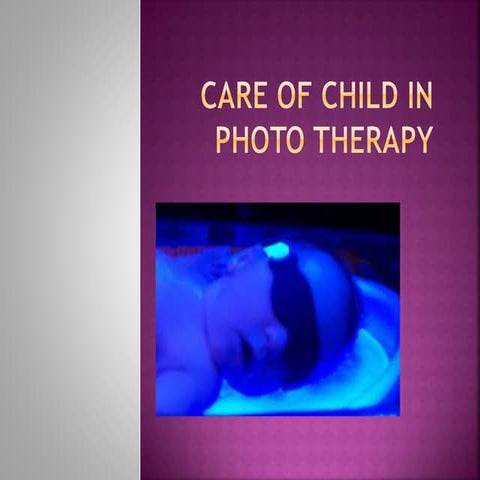 Care of child in  photo therapy