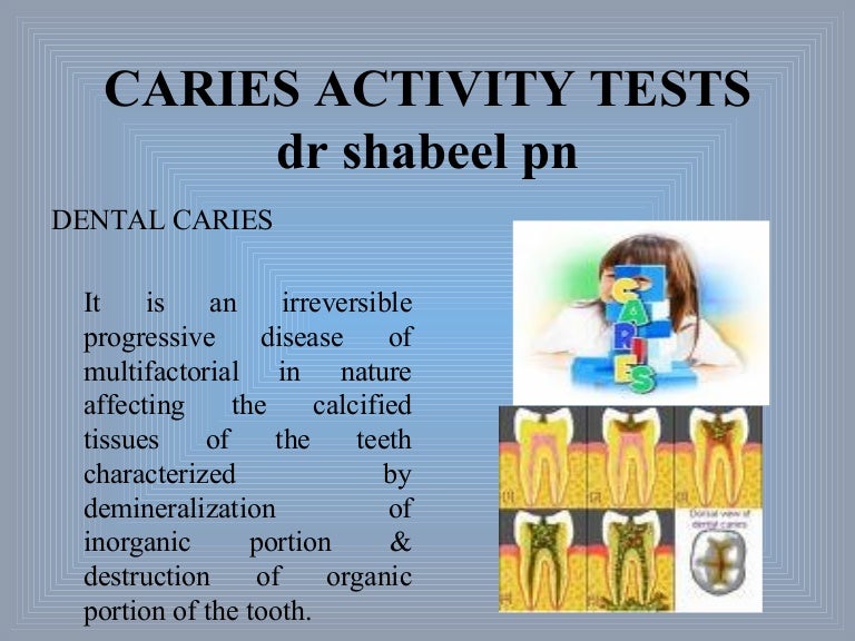 Caries Activity Tests