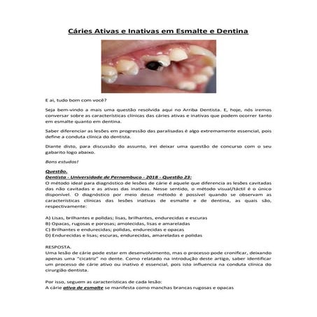 Cáries ativas e inativas em esmalte e dentina | PDF