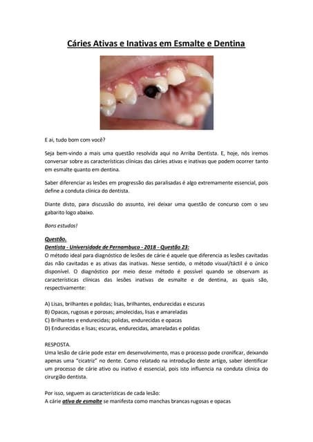 Cáries ativas e inativas em esmalte e dentina | PDF