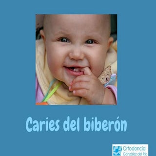 Caries del biberon.docx