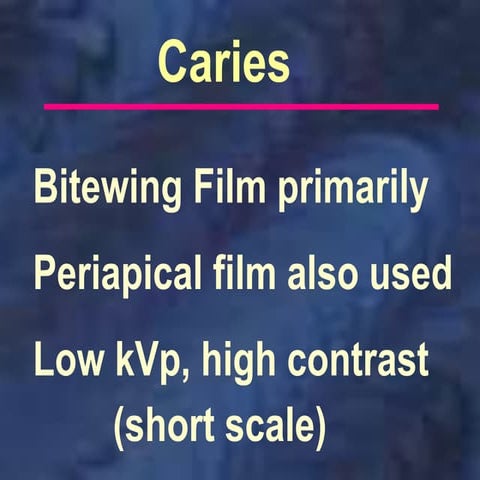 Caries and Periodontal  Localization.ppt
