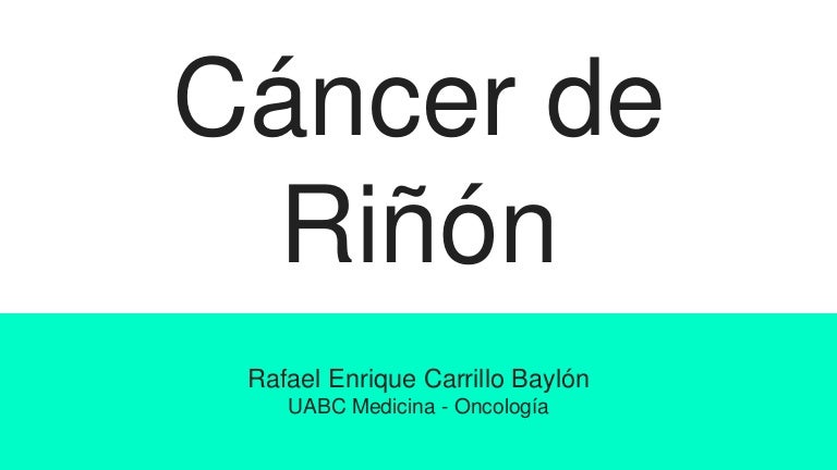 De varicocele lado células derecho renales carcinoma del