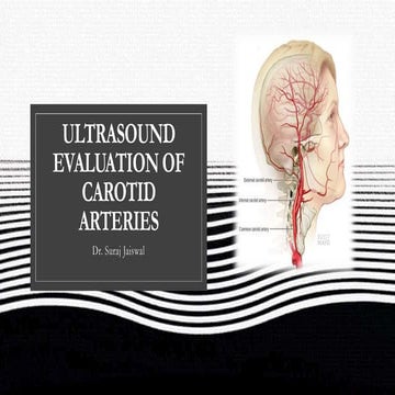 CAROTID DOPPLER BY DR NITIN WADHWANI