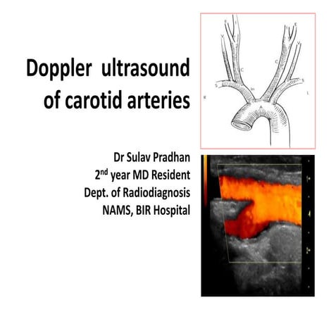 Carotid Doppler 