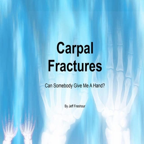 Carpal Fractures