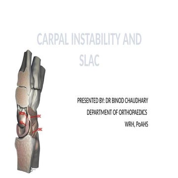 carpal instability and SLAC.pptx by Dr Binod