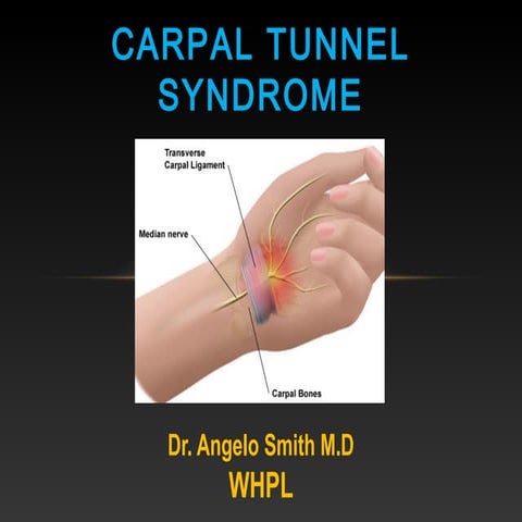 Carpal tunnel syndrome