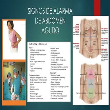 Abdomen agudo