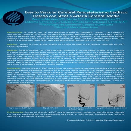 Evento Vascular Cerebral Pericateterismo Cardiaco Tratado con Stent a Arteria Cerebral Media (Stroke after cardiac catheterization)