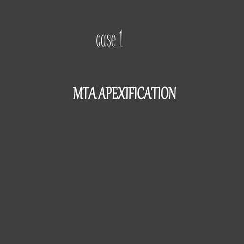 MTA Apexification