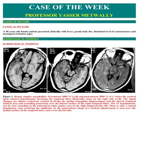Case record...Herpes simplex encephalitis