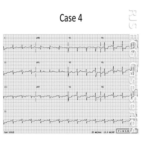 Case 004