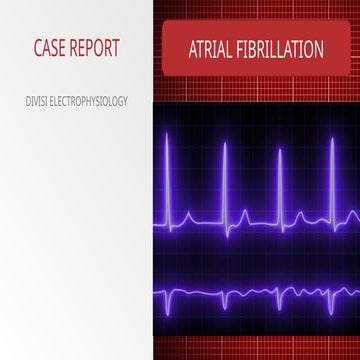 Atrial fibrillation | PPTX