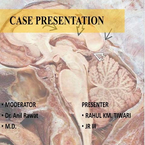Pineal gland tumors | PPT