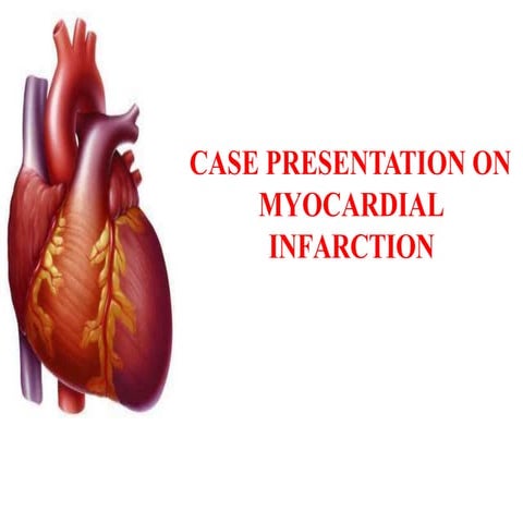 Casepresentation on myocardial infarction
