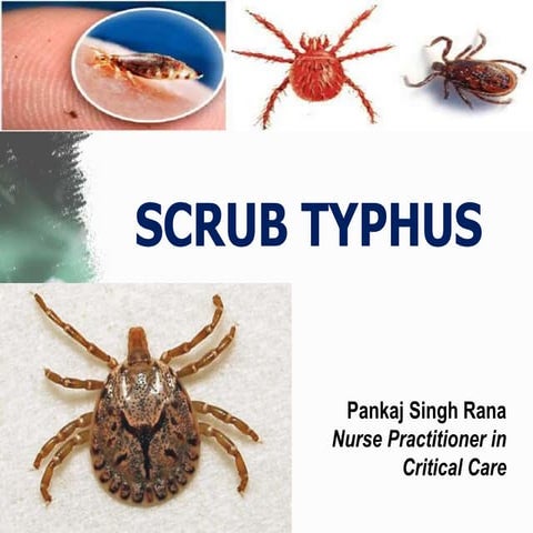 scrub typhus