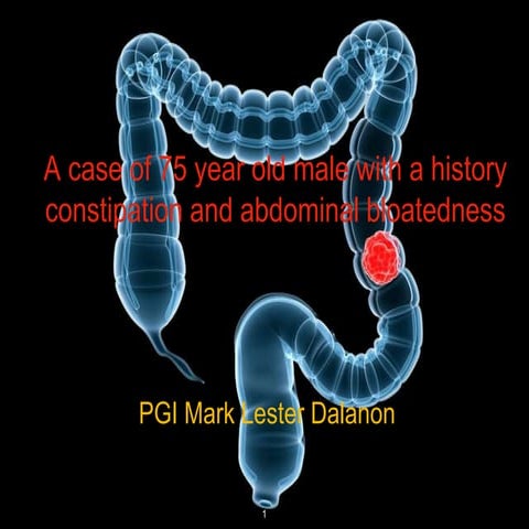 Colon Cancer - A Case Presentation  