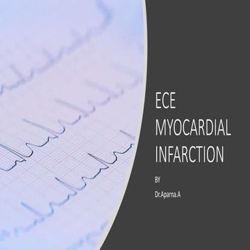 A case presentation on myocardial infarction | PPTX
