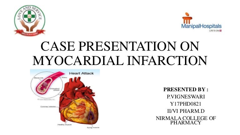 Myocardial infarction case history image