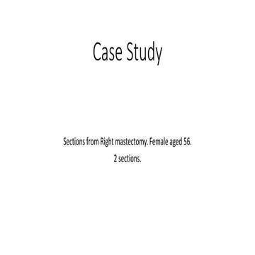 Case study - Breast 