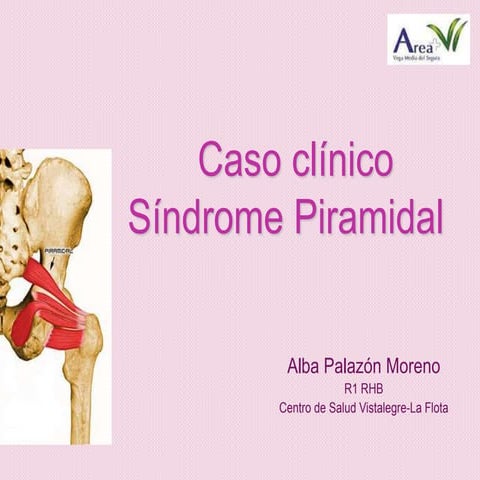 Sindrome Piramidal