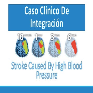Code stroke ecc rn | PPS