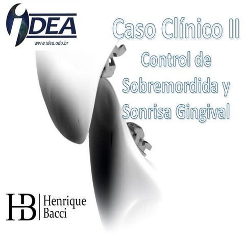 Caso clínico II - Control de Sobremordida y Sonrisa Gingival