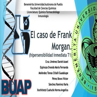 Hipersensibilidad tipo 1 (el caso M...