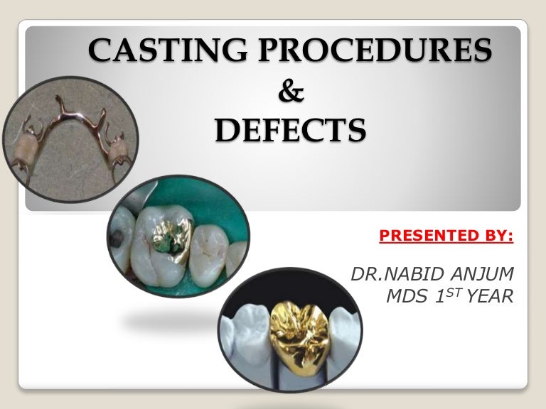 Casting & defects