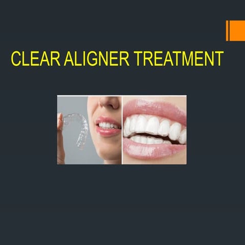 Some of these treatment option includes ceramic brackets, Essix ...