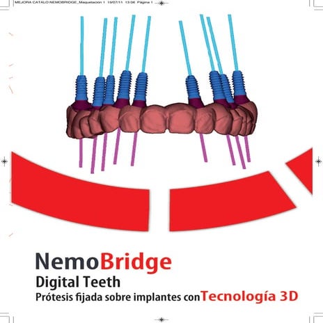 NemoBridge System