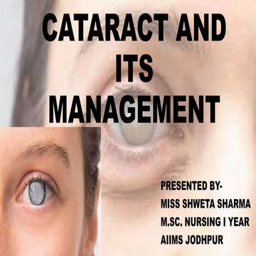 Cataract and its management