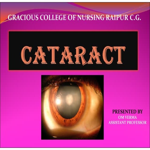 Cataract.pdf