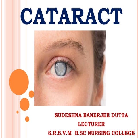 Cataract 