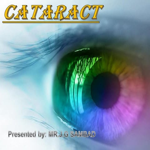 Cataract  