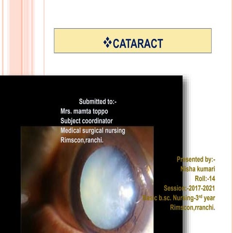 Cataract (eye disease condition)
