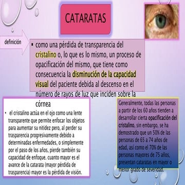 Cataratas | PPT