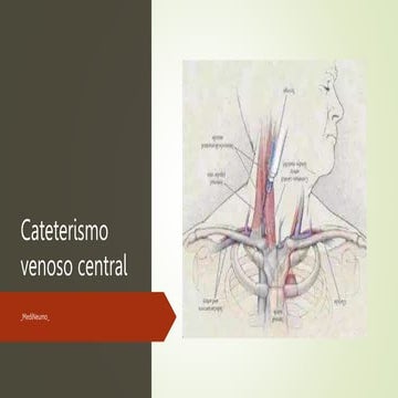 Cateterismo venoso central.pptx