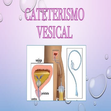 SONDAS VESICAL.pptx........................... | PPTX