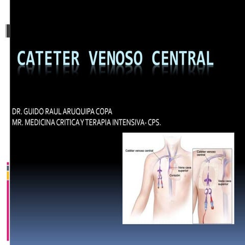 CATETER VENOSO CENTRAL PRESENTACION.pptx