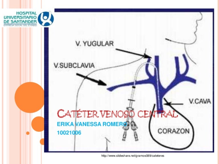 Catéter venoso central