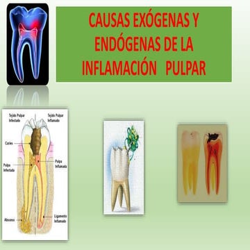 Causas Exogenas y Endogenas.pptx