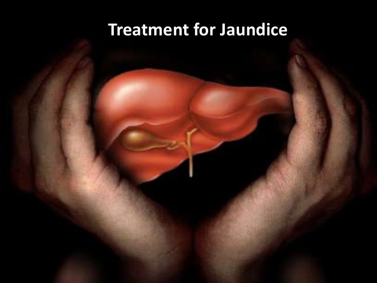 Causes and treatment methods for jaundice