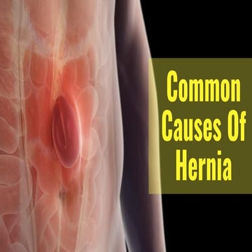 Common Causes Of Hernia