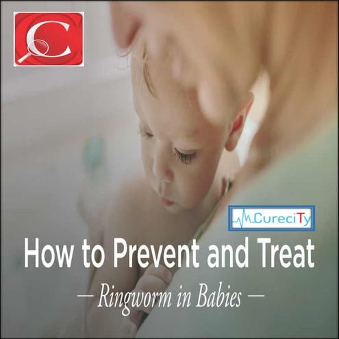 Causes, symptoms and treatments for ringworm - Curecity | PDF