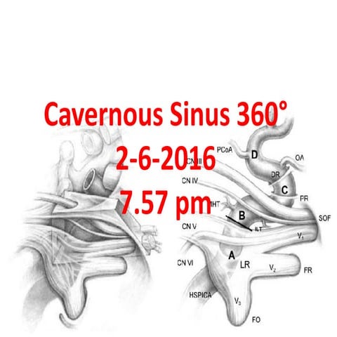 Cavernous sinus 360°