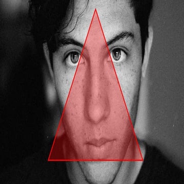 Cavernous Sinus Thrombosis