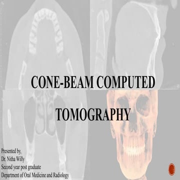 CBCT basic principle,artifacts,landmarks.pptx